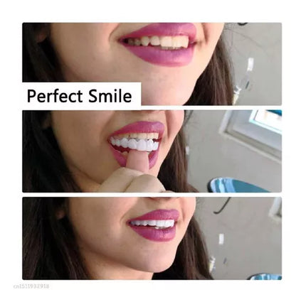 Implantes dentales (Superior+Inferior)