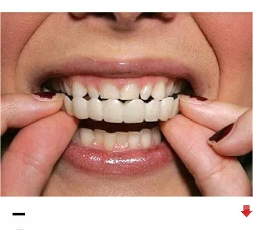 Implantes dentales (Superior+Inferior)